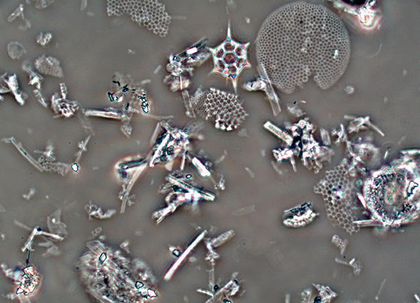 Deeltjes van diatomiet onder een microscoop.