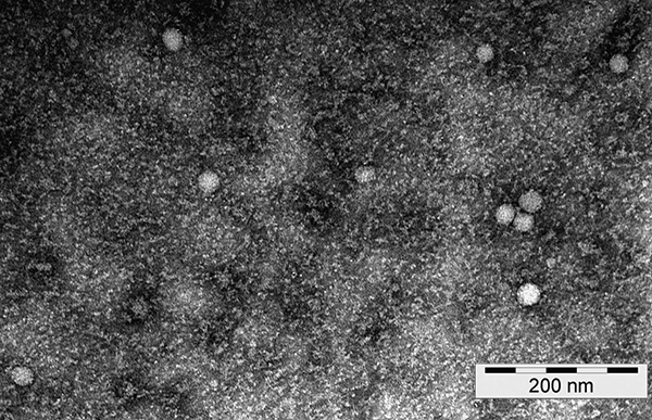 Så här ser partiklar av fästingburen encefalitvirus ut i ett elektronmikroskop.