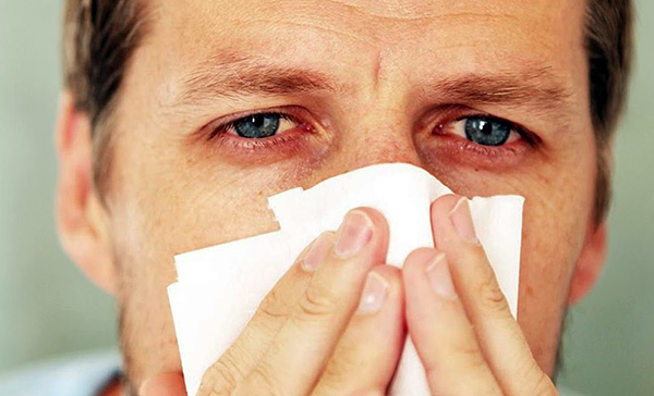 Rinnande näsa, nästäppa och rinnande ögon är typiska symtom som uppstår när allergenet exponeras för de övre luftvägarnas och ögonens slemhinnor.